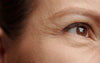 Beyond Retinol: Visible Wrinkle Reduction Without the Side Effects