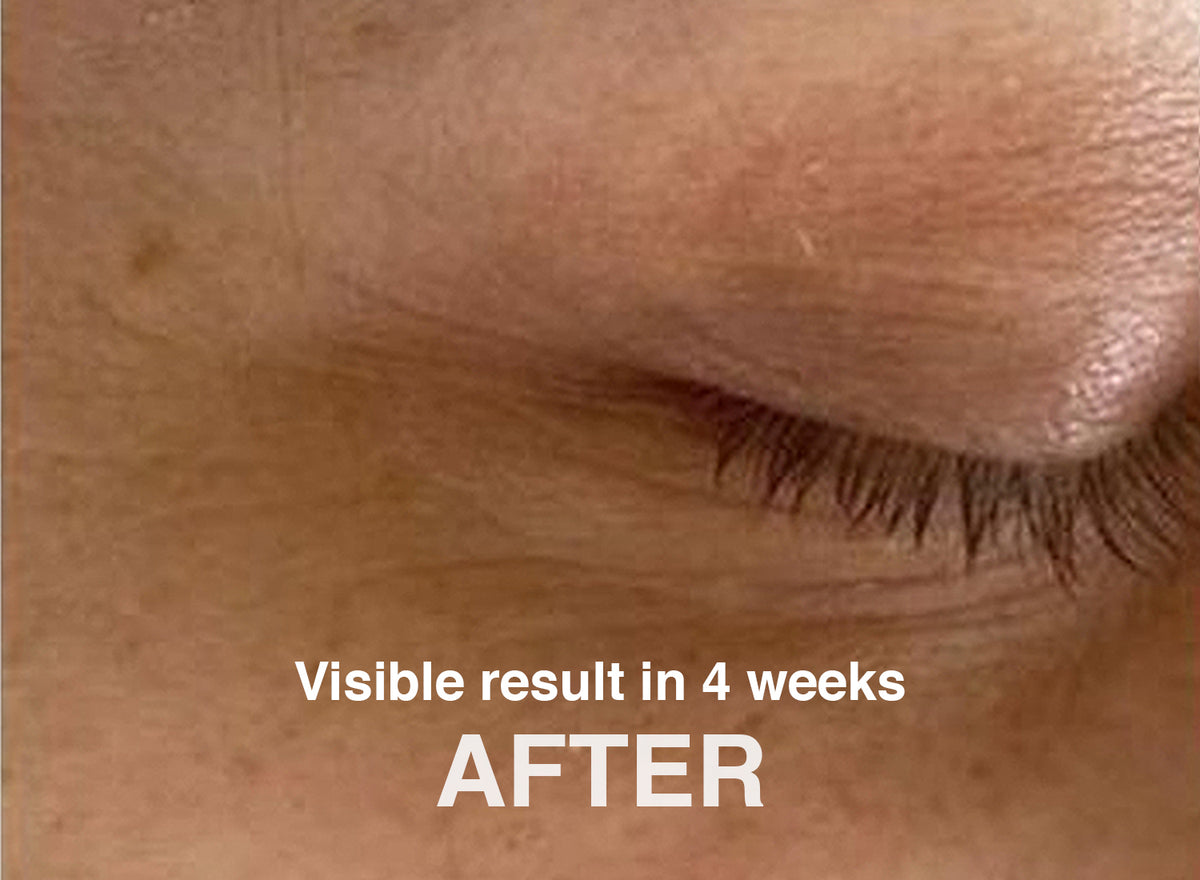 Real Skin. Real Renewal. 