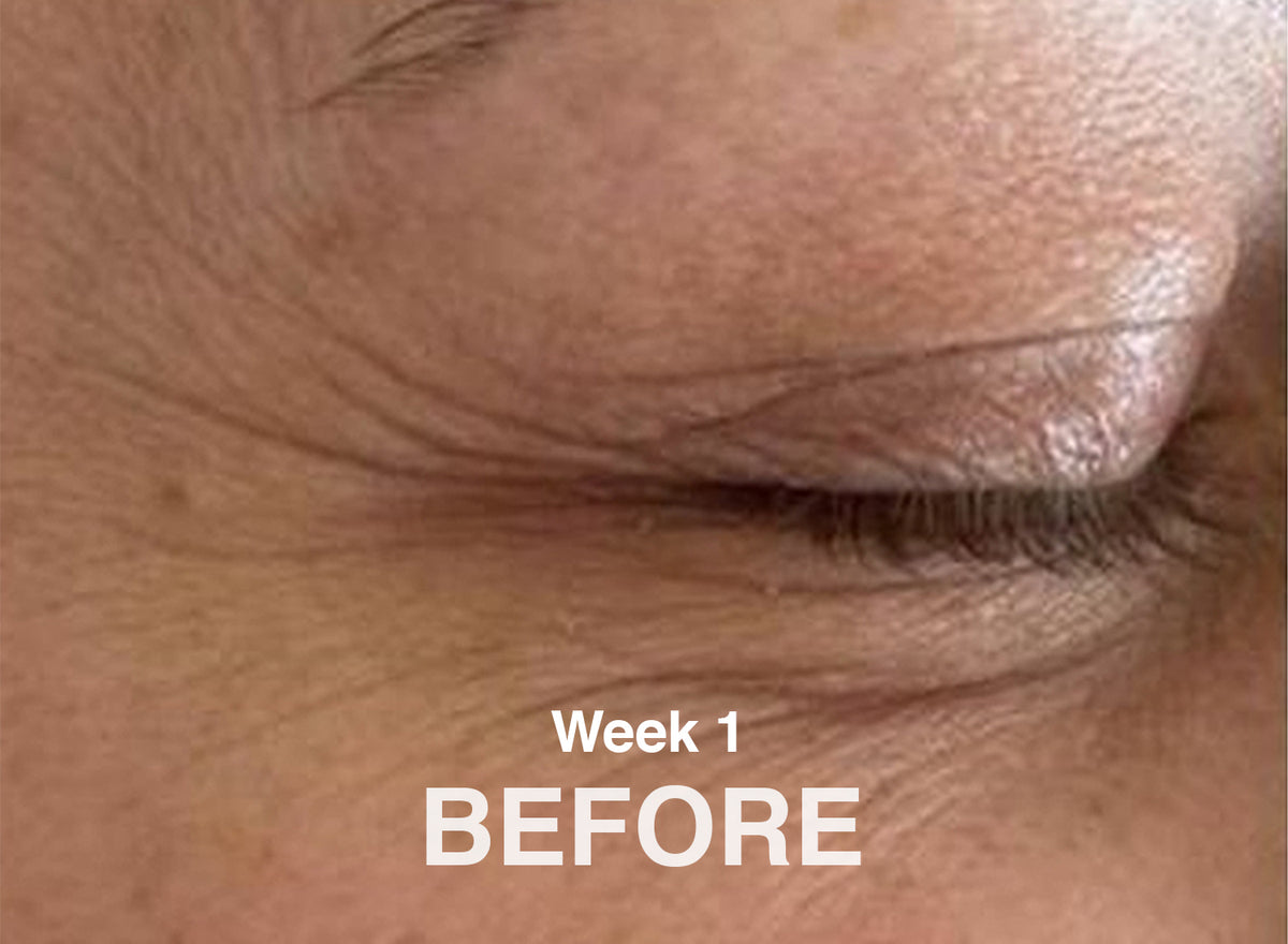 Real Skin. Real Renewal. 