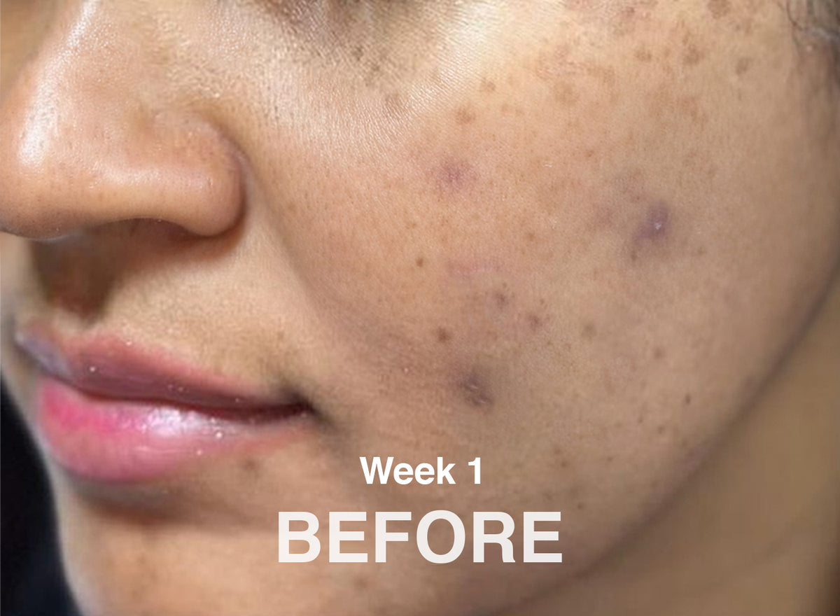 Real Results. Real Clarity.